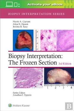 Bertrand.pt - Biopsy Interpretation: The Frozen Section: Print + Ebook With Multimedia