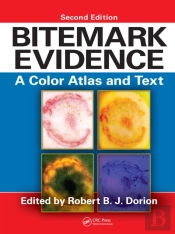 Bitemark Evidence