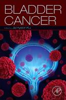 Bladder Cancer