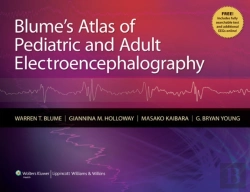 Bertrand.pt - Blume'S Atlas Of Pediatric And Adult Electroencephalography