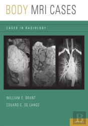 Body Mri Cases
