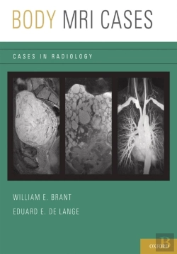 Bertrand.pt - Body Mri Cases