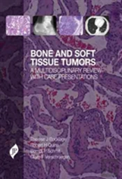 Bone And Soft Tissue Tumors