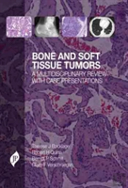 Bertrand.pt - Bone And Soft Tissue Tumors