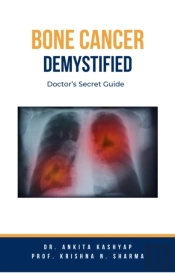Bone Cancer Demystified: Doctor'S Secret Guide