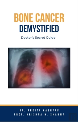 Bertrand.pt - Bone Cancer Demystified: Doctor'S Secret Guide