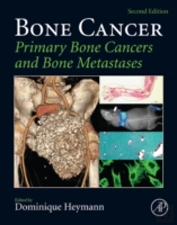 Bertrand.pt - Bone Cancer