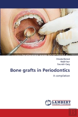 Bertrand.pt - Bone Grafts In Periodontics