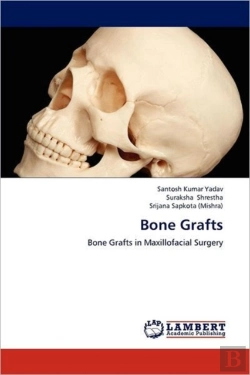 Bertrand.pt - Bone Grafts