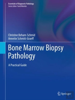 Bertrand.pt - Bone Marrow Biopsy Pathology