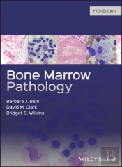Bone Marrow Pathology