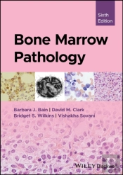 Bone Marrow Pathology