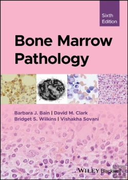 Bertrand.pt - Bone Marrow Pathology