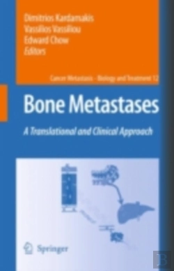 Bertrand.pt - Bone Metastases