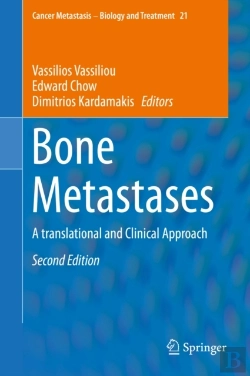 Bertrand.pt - Bone Metastases