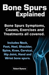 Bone Spurs Explained. Bone Spurs Symptoms, Causes, Exercises And Treatments All Covered. Includes Neck, Foot, Heel, Shoulder, Spine, Knee, Cervical, H
