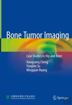 Bertrand.pt - Bone Tumor Imaging