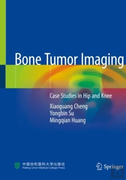 Bertrand.pt - Bone Tumor Imaging