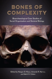 Bones Of Complexity