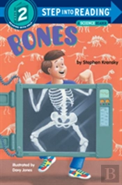 Bones