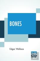 Bones