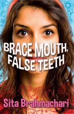 Bertrand.pt - Brace Mouth, False Teeth