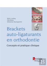 Brackets Auto-Ligaturants En Orthodontie ; Concepts Et Pratique Clinique