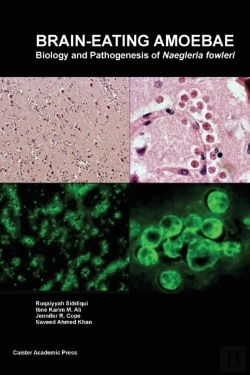 Bertrand.pt - Brain-Eating Amoebae