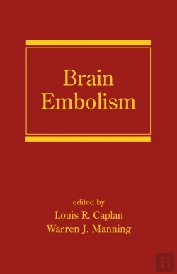 Bertrand.pt - Brain Embolism