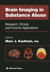 Brain Imaging In Substance Abuse