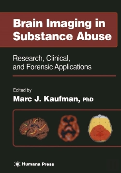 Bertrand.pt - Brain Imaging In Substance Abuse