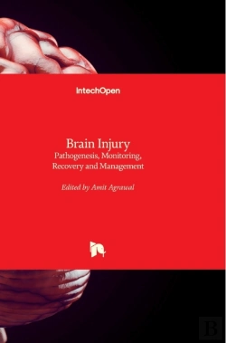 Bertrand.pt - Brain Injury