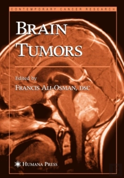 Bertrand.pt - Brain Tumors