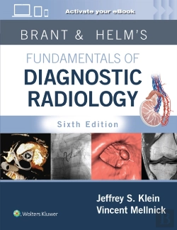 Bertrand.pt - Brant & Helms' Fundamentals Of Diagnostic Radiology: Print + Ebook With Multimedia