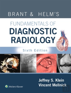 Bertrand.pt - Brant & Helm'S Fundamentals Of Diagnostic Radiology