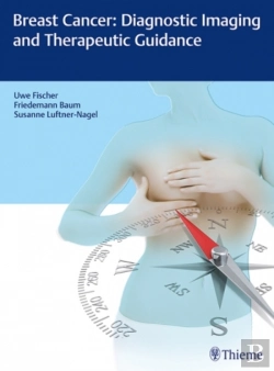Bertrand.pt - Breast Cancer: Diagnostic Imaging And Therapeutic Guidance