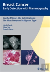 Breast Cancer: Early Detection With Mammography