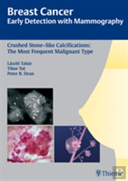 Bertrand.pt - Breast Cancer: Early Detection With Mammography