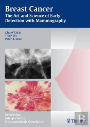 Breast Cancer - The Art And Science Of Early Detection With Mammography