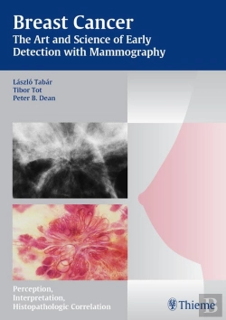 Bertrand.pt - Breast Cancer - The Art And Science Of Early Detection With Mammography