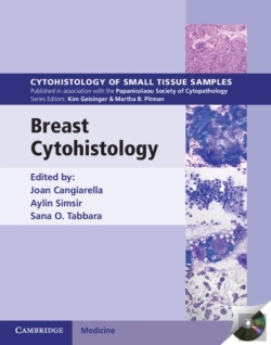 Bertrand.pt - Breast Cytohistology