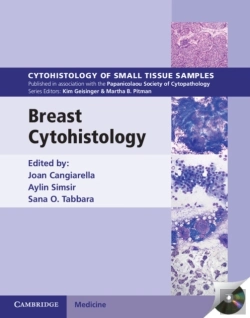 Bertrand.pt - Breast Cytohistology