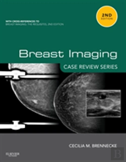 Bertrand.pt - Breast Imaging