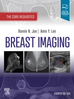 Bertrand.pt - Breast Imaging, E-Book