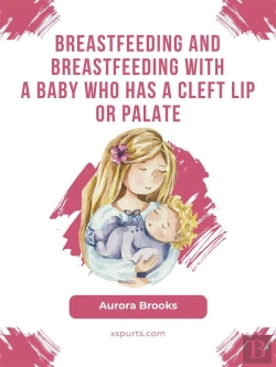 Bertrand.pt - Breastfeeding And Breastfeeding With A Baby Who Has A Cleft Lip Or Palate