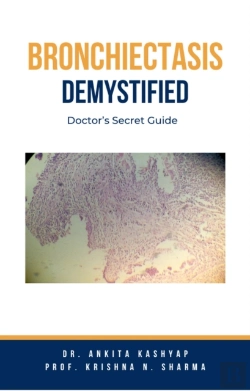 Bertrand.pt - Bronchiectasis Demystified: Doctor'S Secret Guide