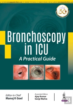 Bertrand.pt - Bronchoscopy In Icu: A Practical Guide