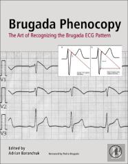 Brugada Phenocopy
