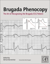 Brugada Phenocopy