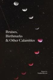 Bruises, Birthmarks   Other Calamities